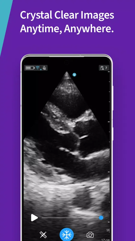 Vscan Air Screenshots