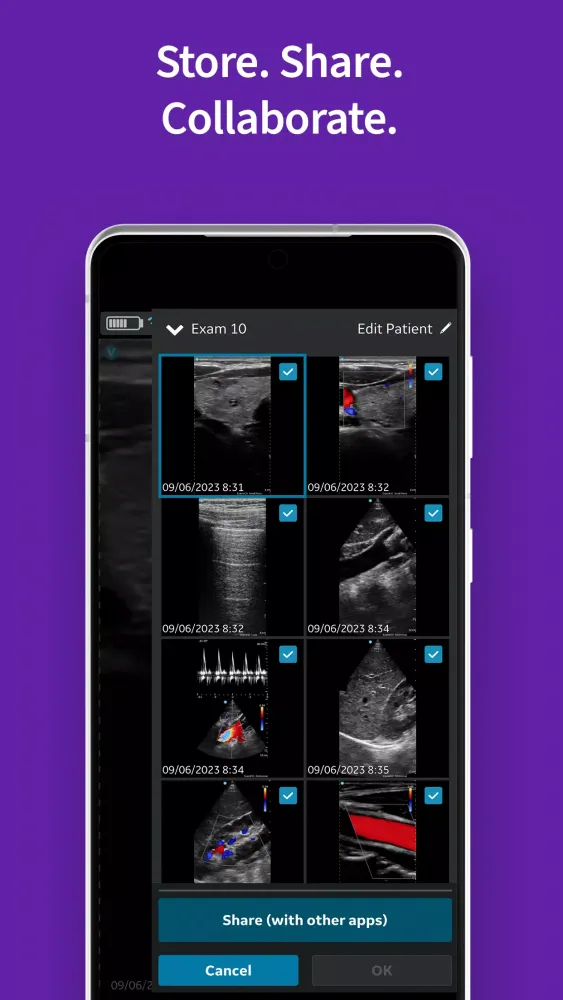 Vscan Air Screenshots