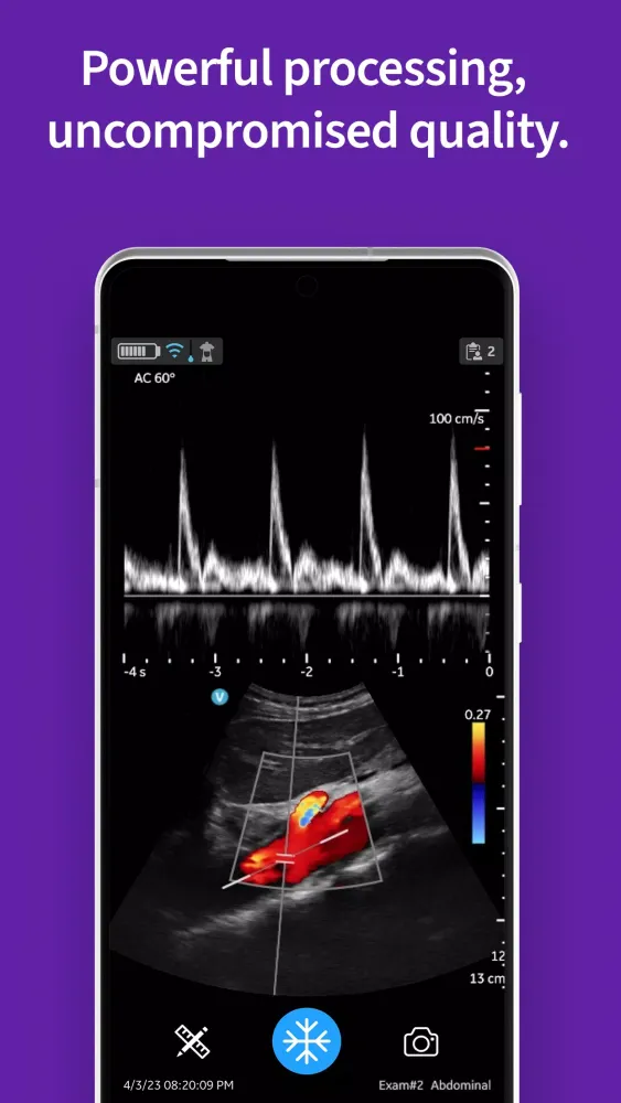 Vscan Air Screenshots