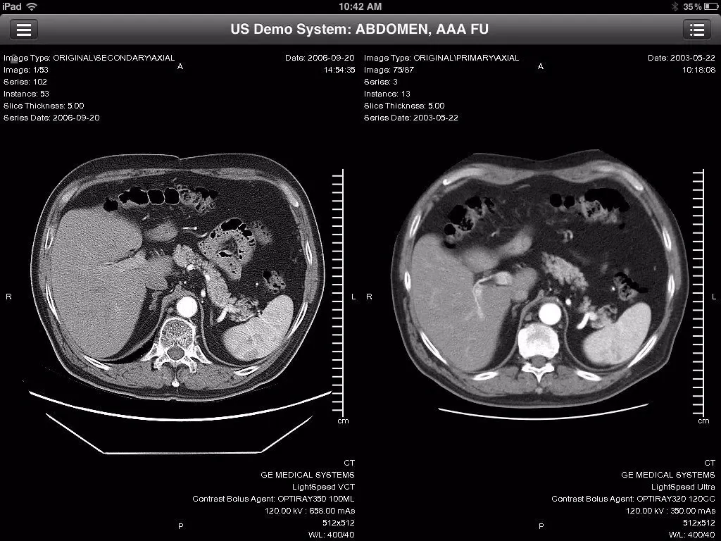 Скриншоты Centricity Radiology Mobile Access (International) iPad 