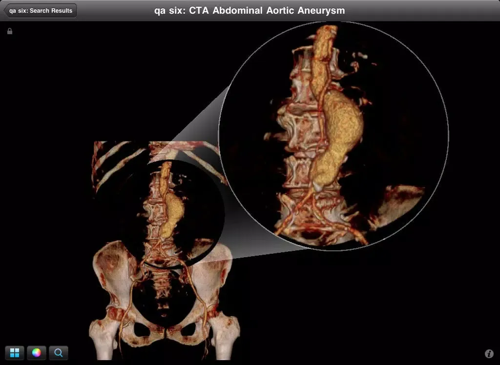 Скриншоты Centricity Radiology Mobile Access (International) iPad 