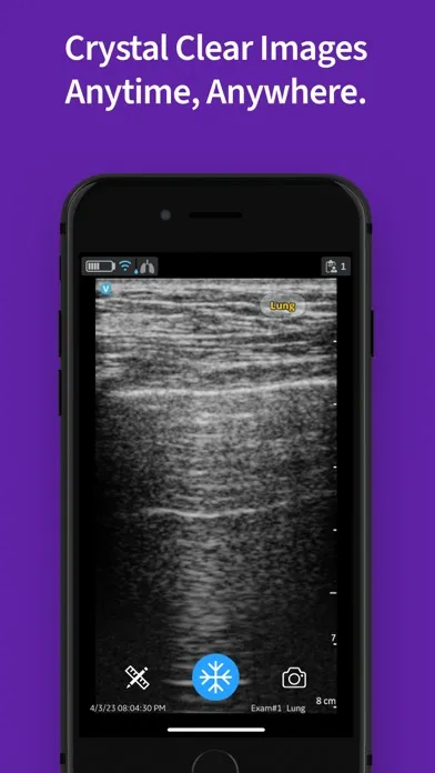 Vscan Air VET Ultrasound Screenshots