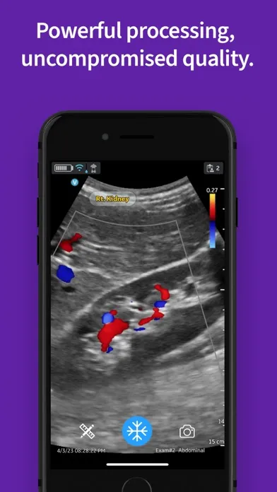 Vscan Air VET Ultrasound Screenshots