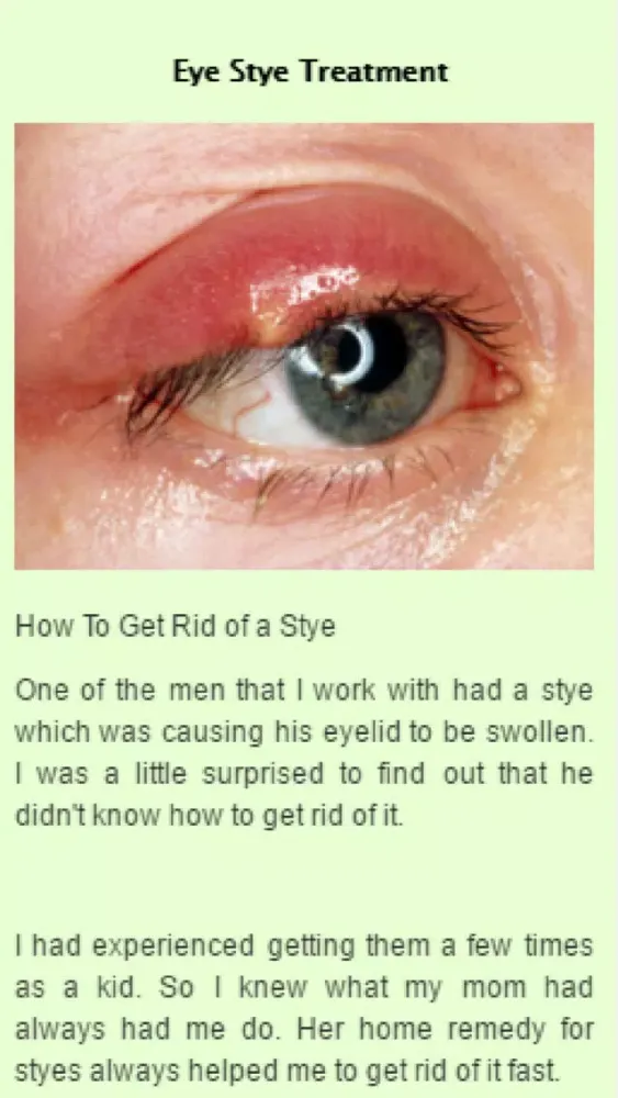 How to Get Rid Of A Stye应用截图