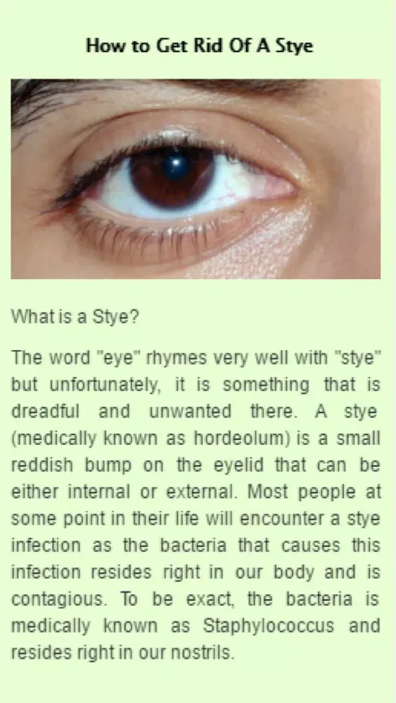 How to Get Rid Of A Stye应用截图