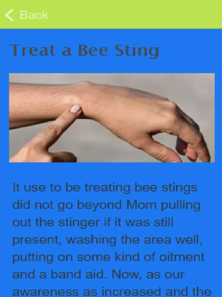 صور How To Treat A Wasp Sting iPad 
