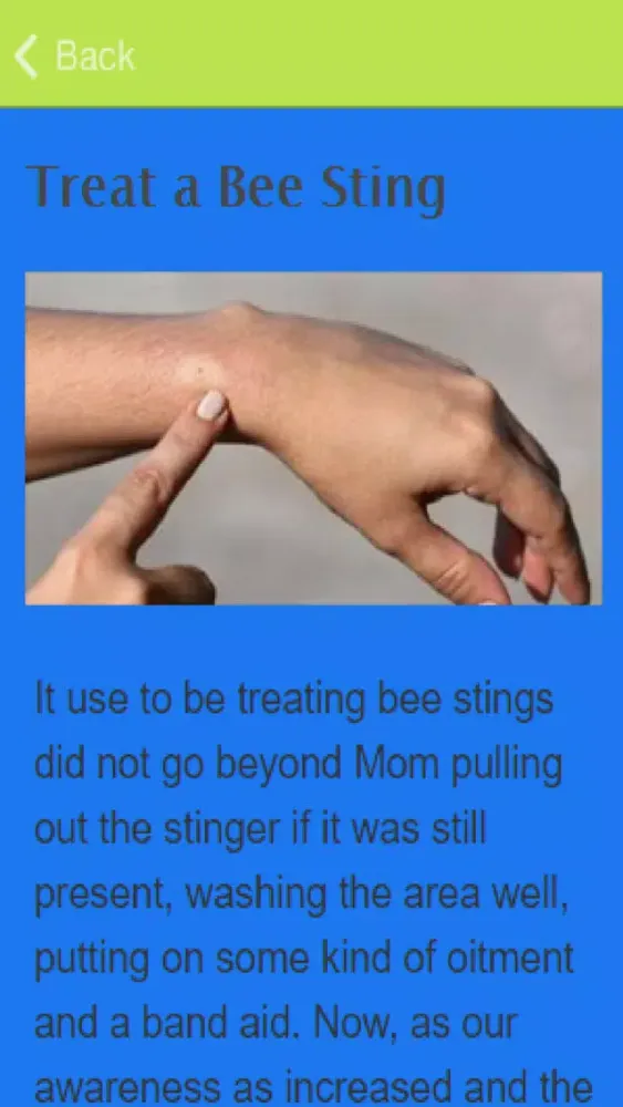 صور How To Treat A Wasp Sting