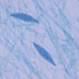 Microbiology and Immunology Lippincott's Illustrated Q&A Review