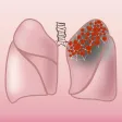 Thrombosis Consult Thrombosis Consult