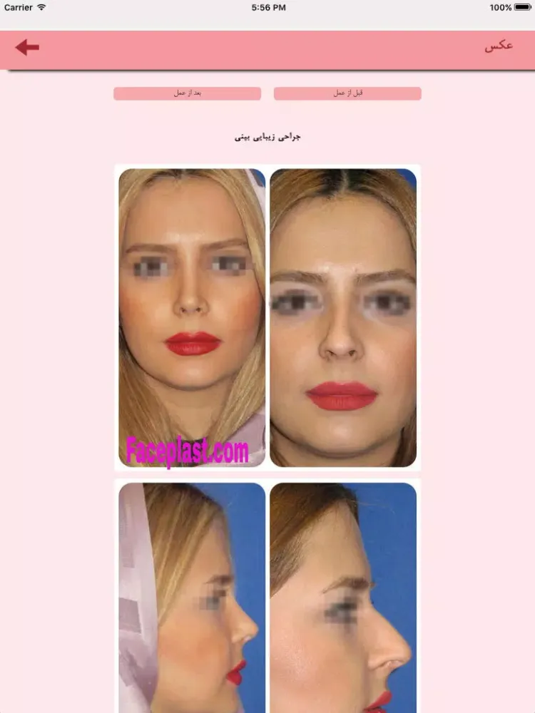 Captures d'écran de جراحی زیبایی بینی و صورت iPad 