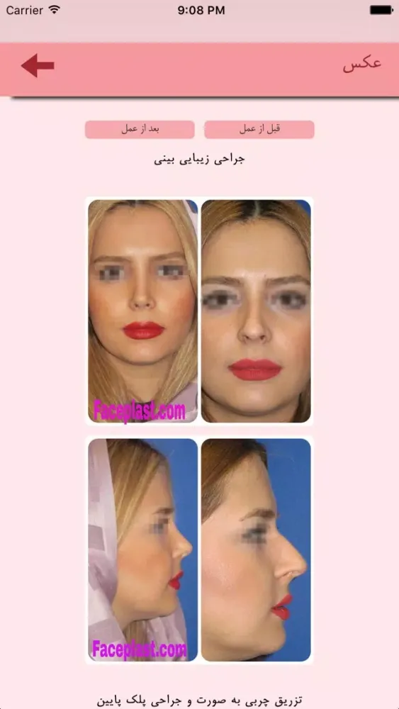 Captures d'écran de جراحی زیبایی بینی و صورت
