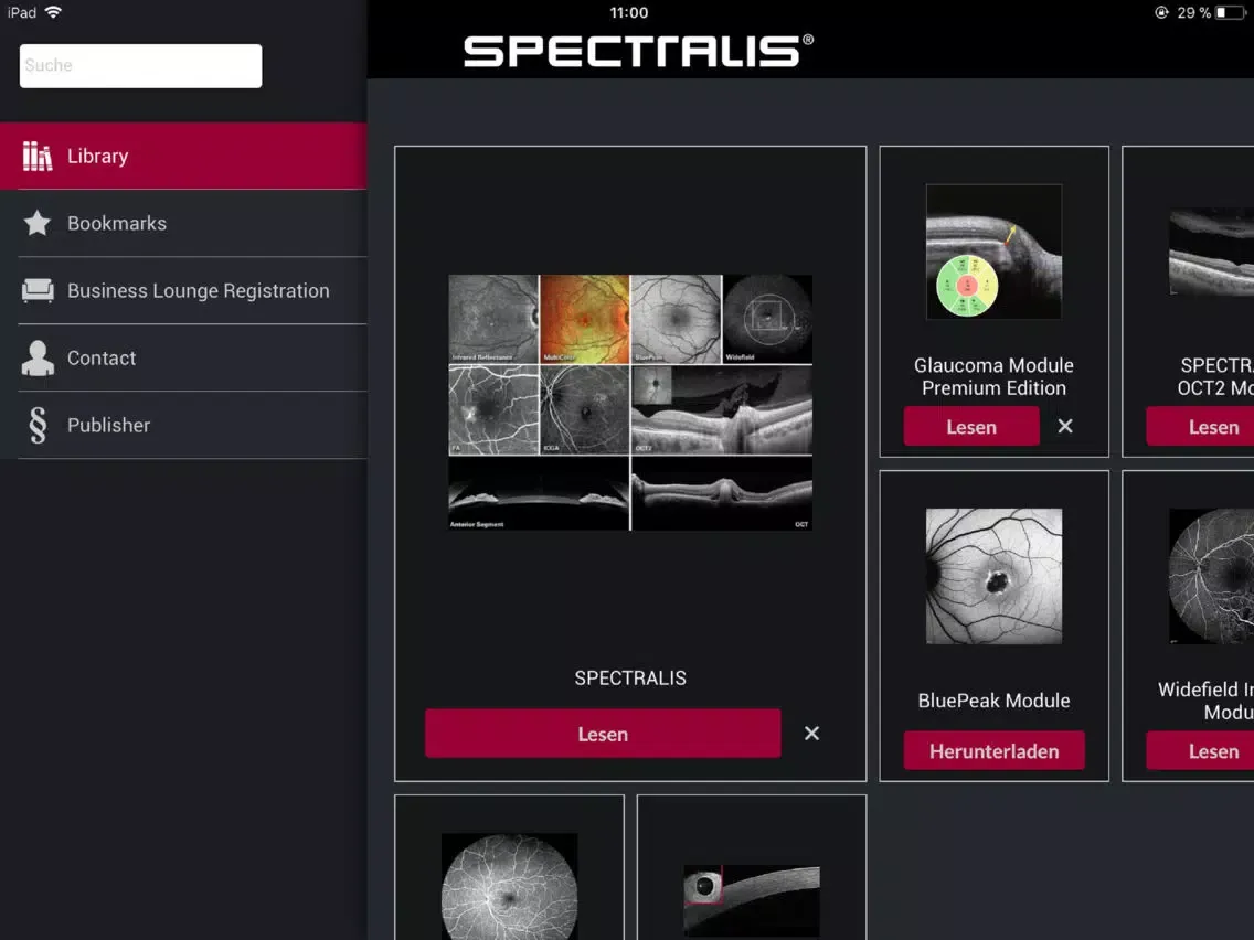 Tangkapan layar SPECTRALIS US iPad 