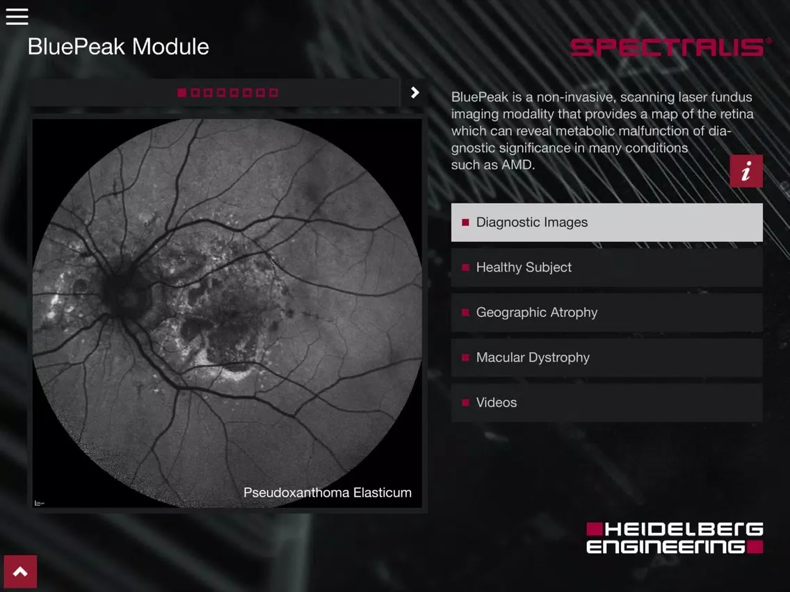 Tangkapan layar SPECTRALIS US iPad 