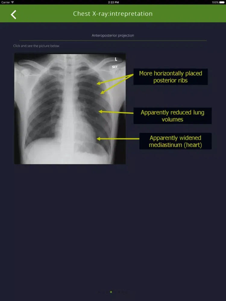 Chest Radiographs iPad  Ekran Görüntüleri