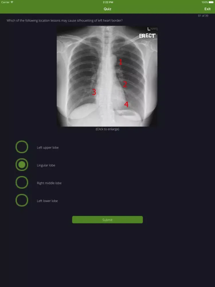 Chest Radiographs iPad  Ekran Görüntüleri