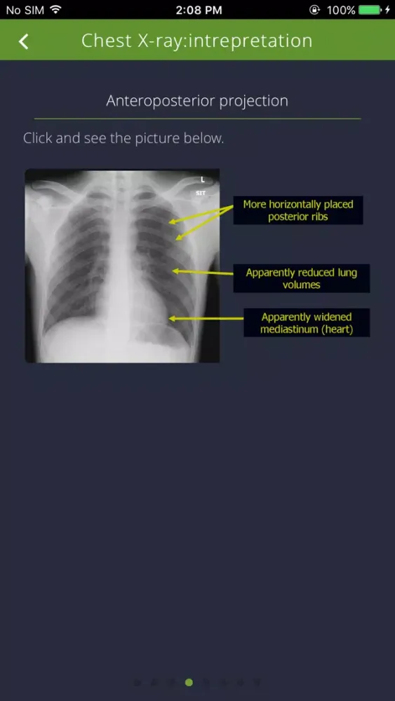 Chest Radiographs Ekran Görüntüleri
