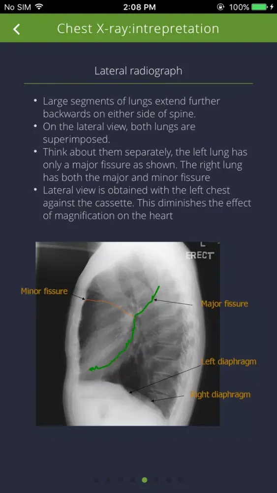 Chest Radiographs Ekran Görüntüleri