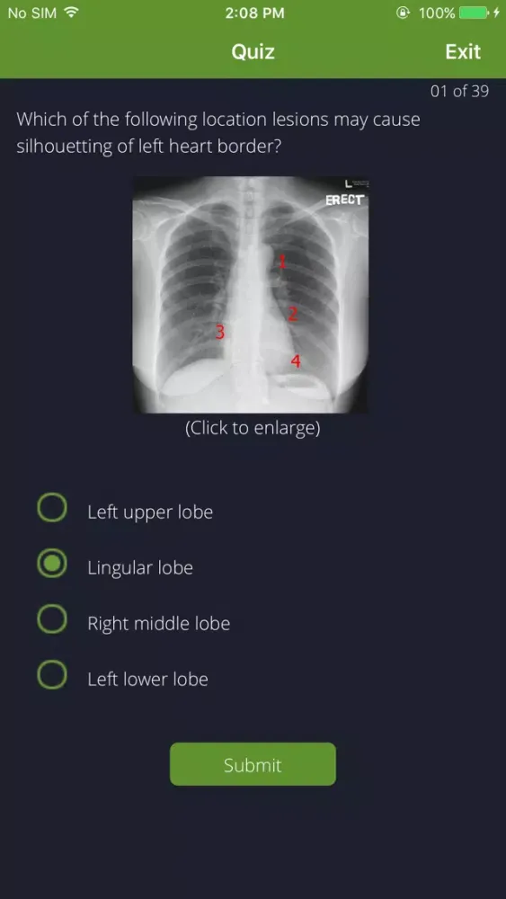 Chest Radiographs Ekran Görüntüleri