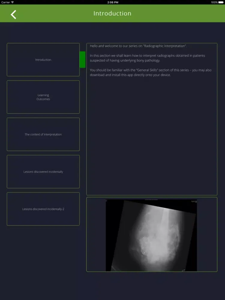 Bone Lesions iPad Screenshots