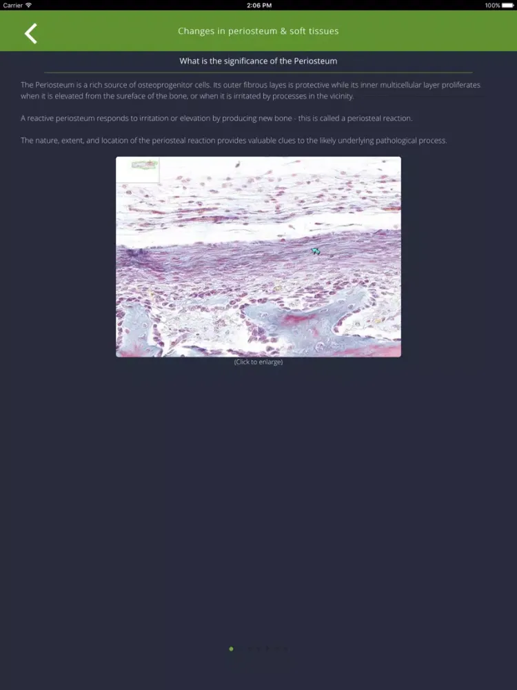 Bone Lesions iPad Screenshots