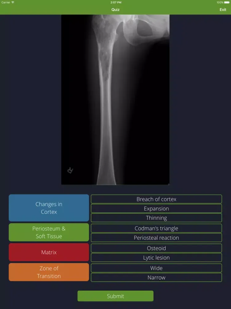 Bone Lesions iPad Screenshots