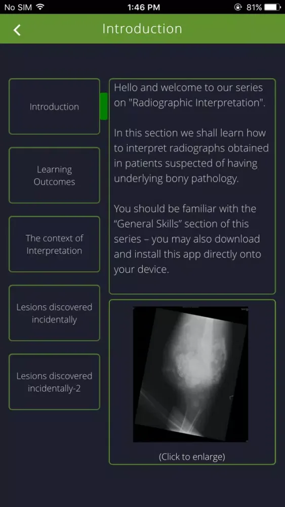 Bone Lesions Screenshots