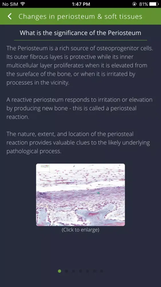 Bone Lesions Screenshots