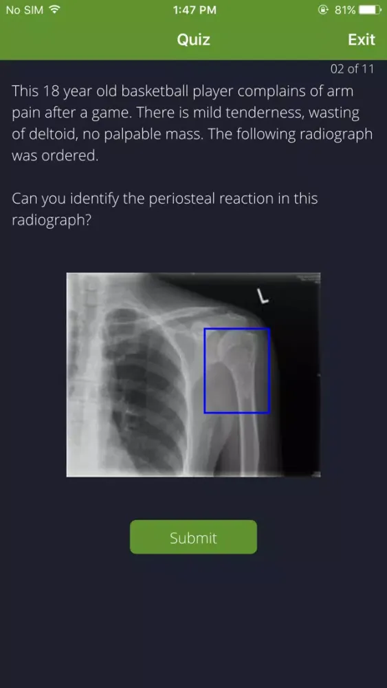 Bone Lesions Screenshots