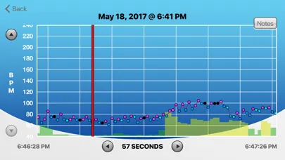 تصاویر HRV Trace