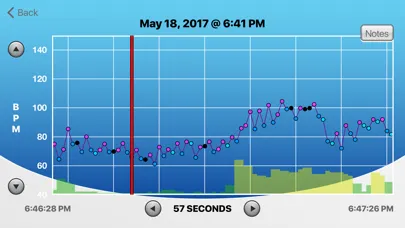 تصاویر HRV Trace