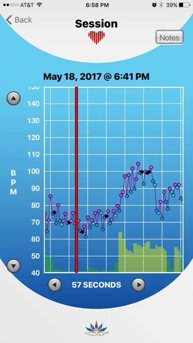 تصاویر HRV Trace