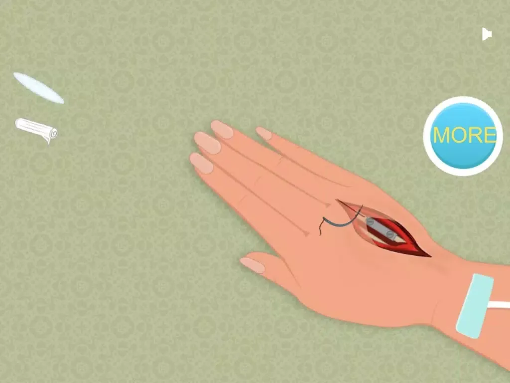 Capturas de tela do Hand Surgeon : First Aid iPad 