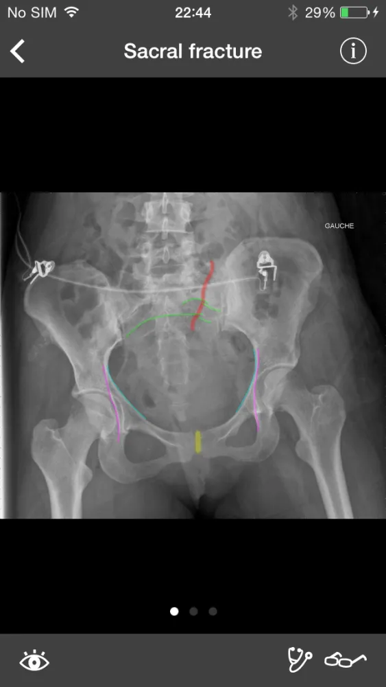 Capturas de pantalla de RealWorld Orthopaedics