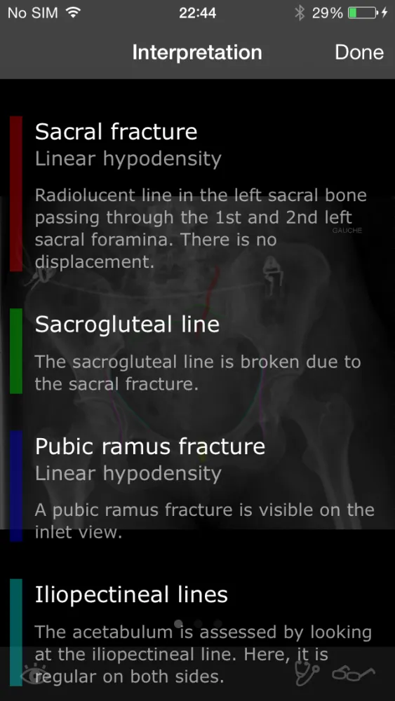 Capturas de pantalla de RealWorld Orthopaedics