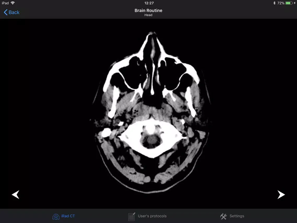 iRad CT iPad 应用截图