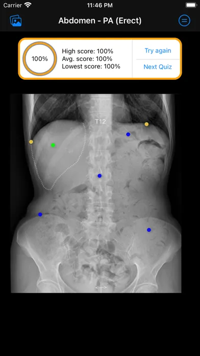 Xray Anatomy Screenshots