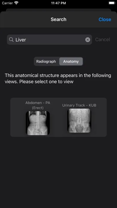 Xray Anatomy Screenshots
