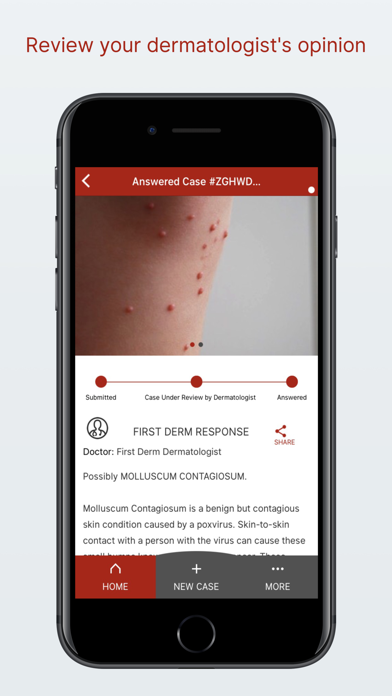Tangkapan skrin STD Triage Ask dermatologist