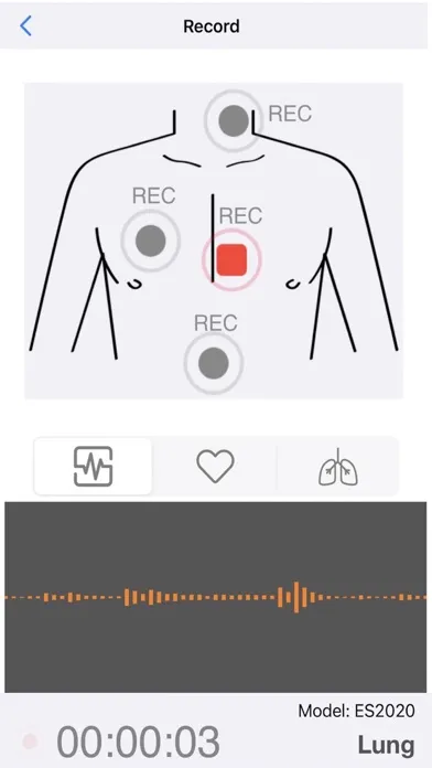 Smart Stethoscope 스크린샷