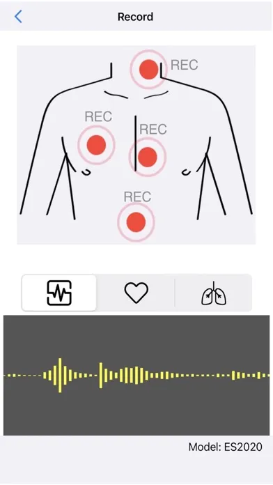 Smart Stethoscope 스크린샷