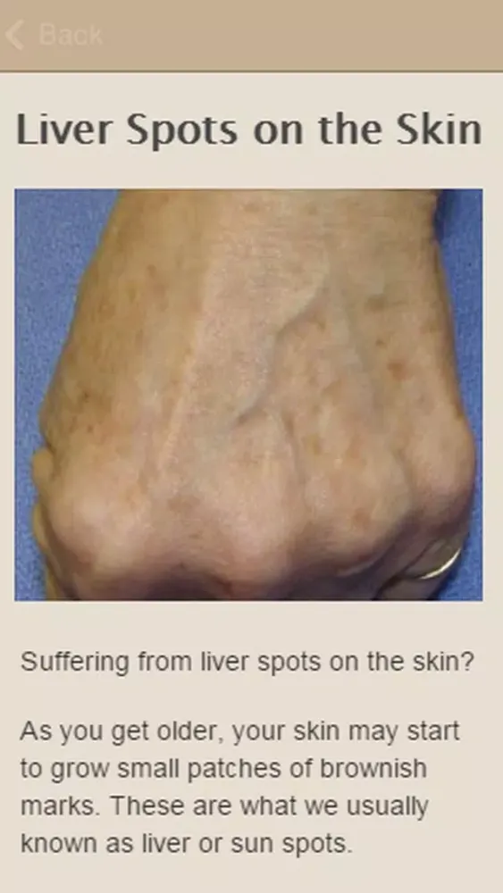 Tangkapan skrin How To Remove Liver Spots