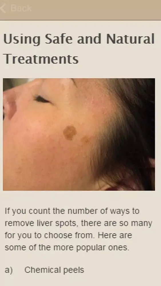 Tangkapan skrin How To Remove Liver Spots
