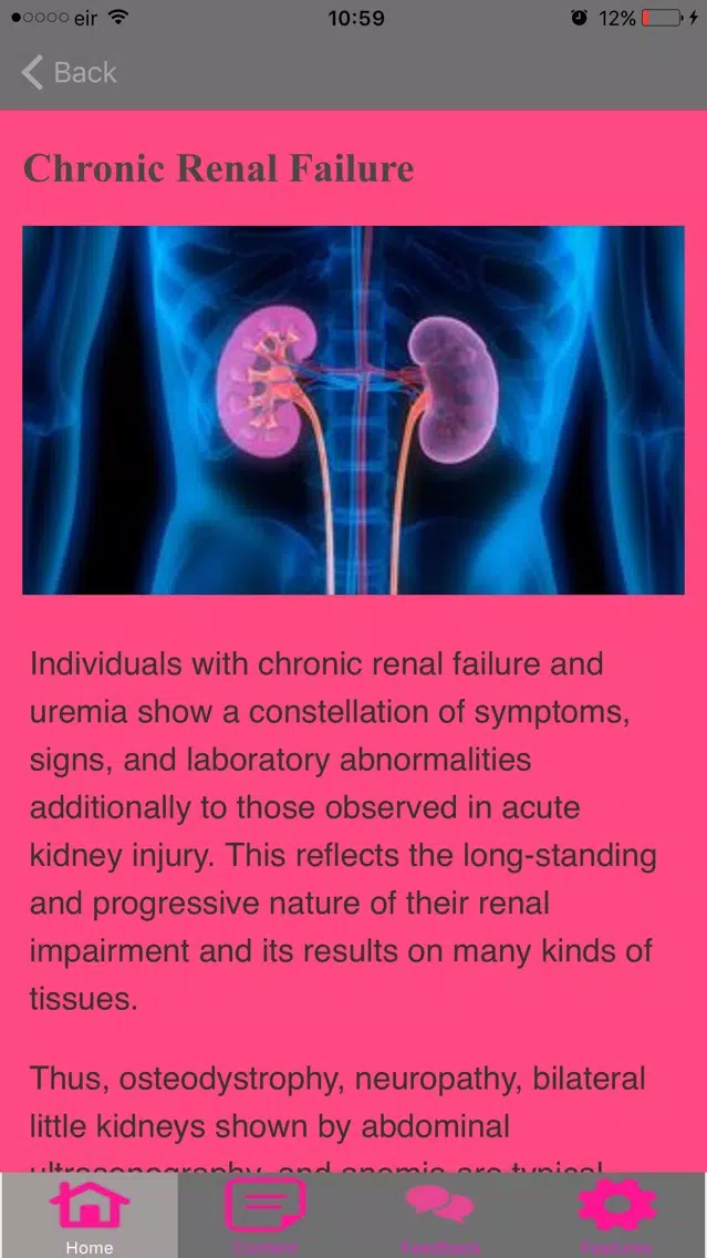 Symptoms Of Renal Failure سکرین شاٹس