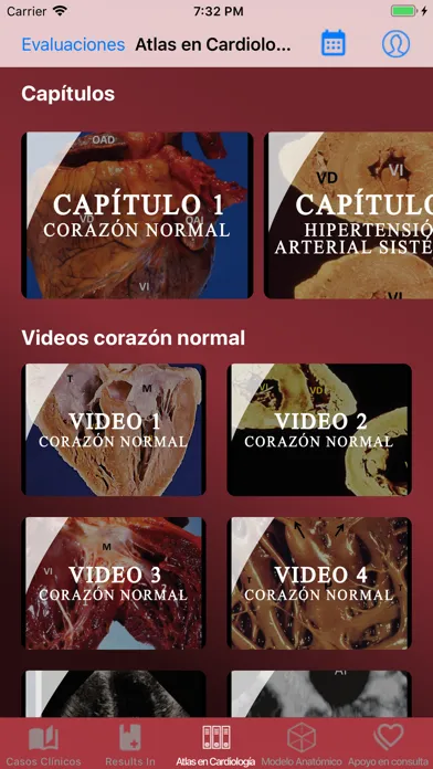 Capturas de pantalla de Cardiology Today