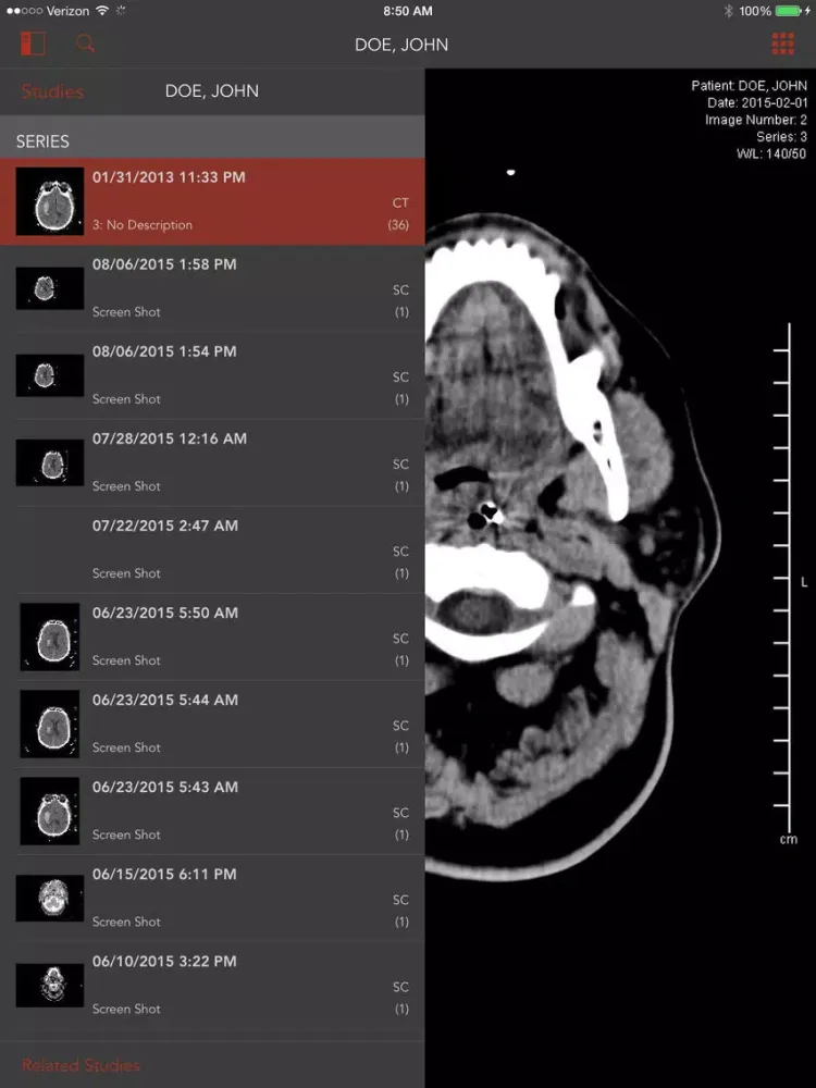 Tangkapan layar PACS Viewer iPad 