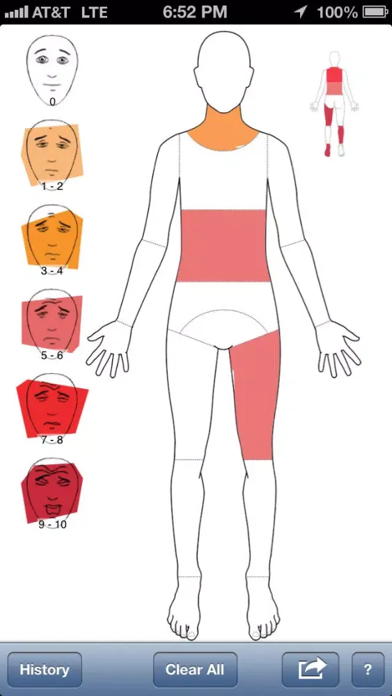 Zrzuty ekranu PainTrackr - Track Pain, Chronic Pain, and Pain History