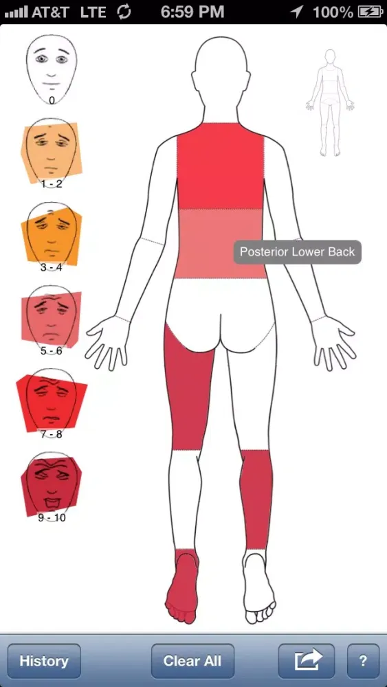 Zrzuty ekranu PainTrackr - Track Pain, Chronic Pain, and Pain History