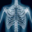 Pneumonia Checker