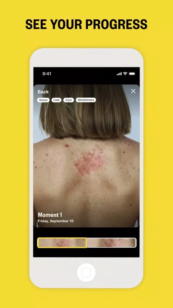 Captures d'écran de ITCHY - Psoriasis & Eczema