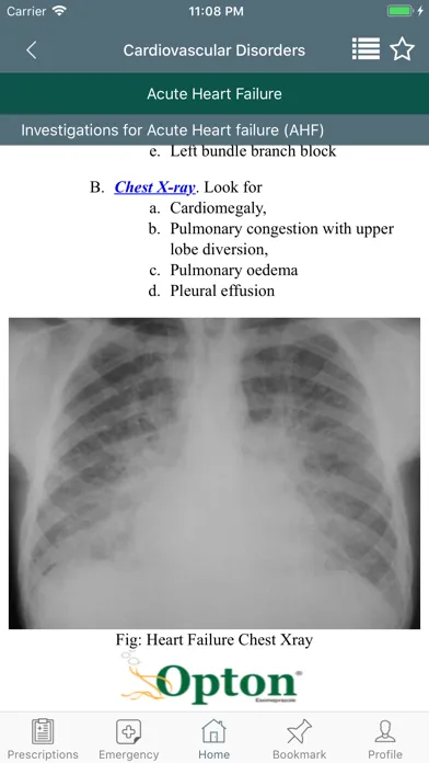 ภาพหน้าจอของ PDM - ITmedicus